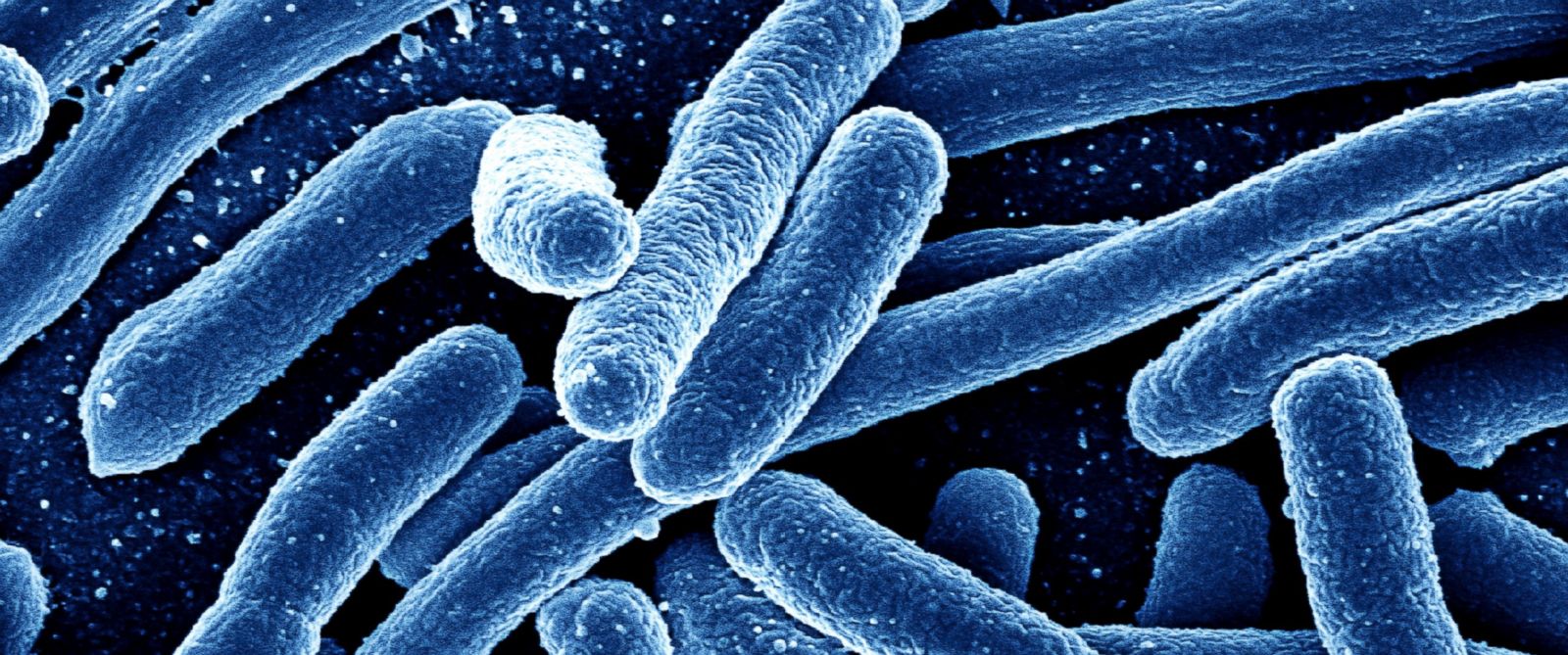 Mysterious compound called “F19” discovered by Israeli researchers to kill antibiotic-resistant superbugs without encouraging resistance