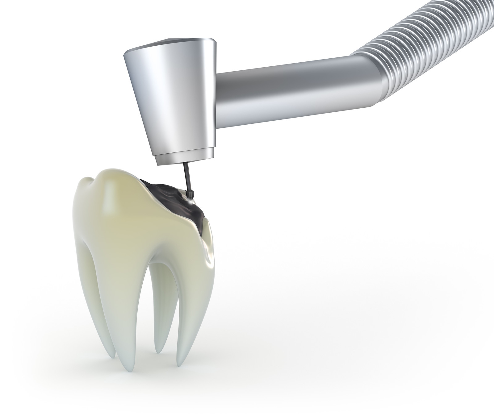 Is your dentist mercury-safe, or just mercury-free?