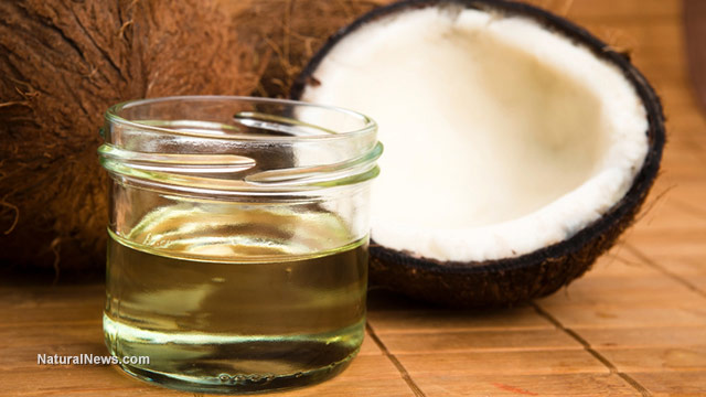 Coconut oil can prevent tooth decay better than toxic fluoride