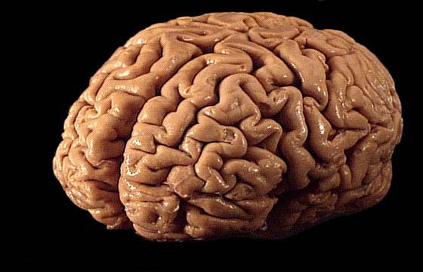 Scientists are growing hundreds of human brains for testing