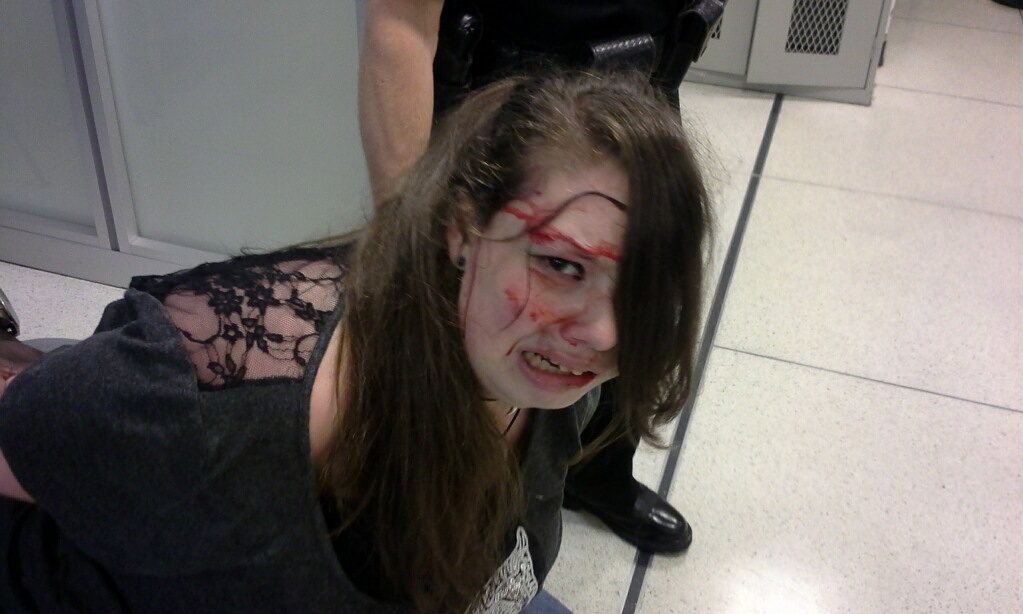 Undeniable tyranny: TSA beats a blind, deaf teenage girl to a bloody pulp while claiming to protect us all from terrorists