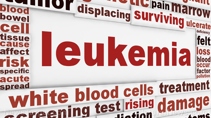 Cannabis phytochemicals found to be effective in destroying leukemia cells