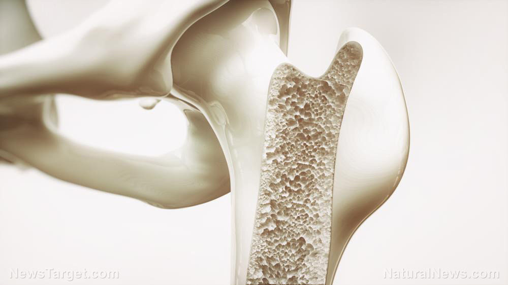 Scientists develop a new biomaterial made from citrate to help hasten bone regeneration