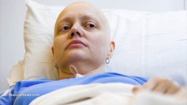 Is chemotherapy worth it? Studies prove that the chemical intervention actually worsens quality of life and has no benefit to overall survival