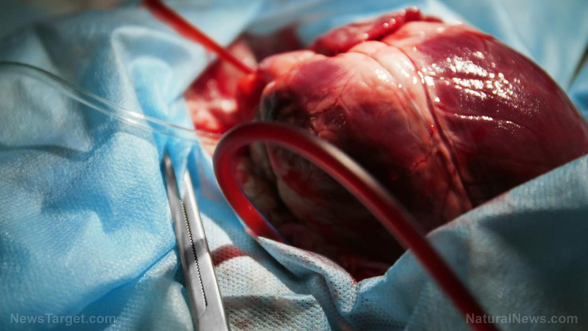 Global cardiac pacemaker market experiencing MAJOR “uptick” due to deadly Covid vaccines clogging blood and straining hearts